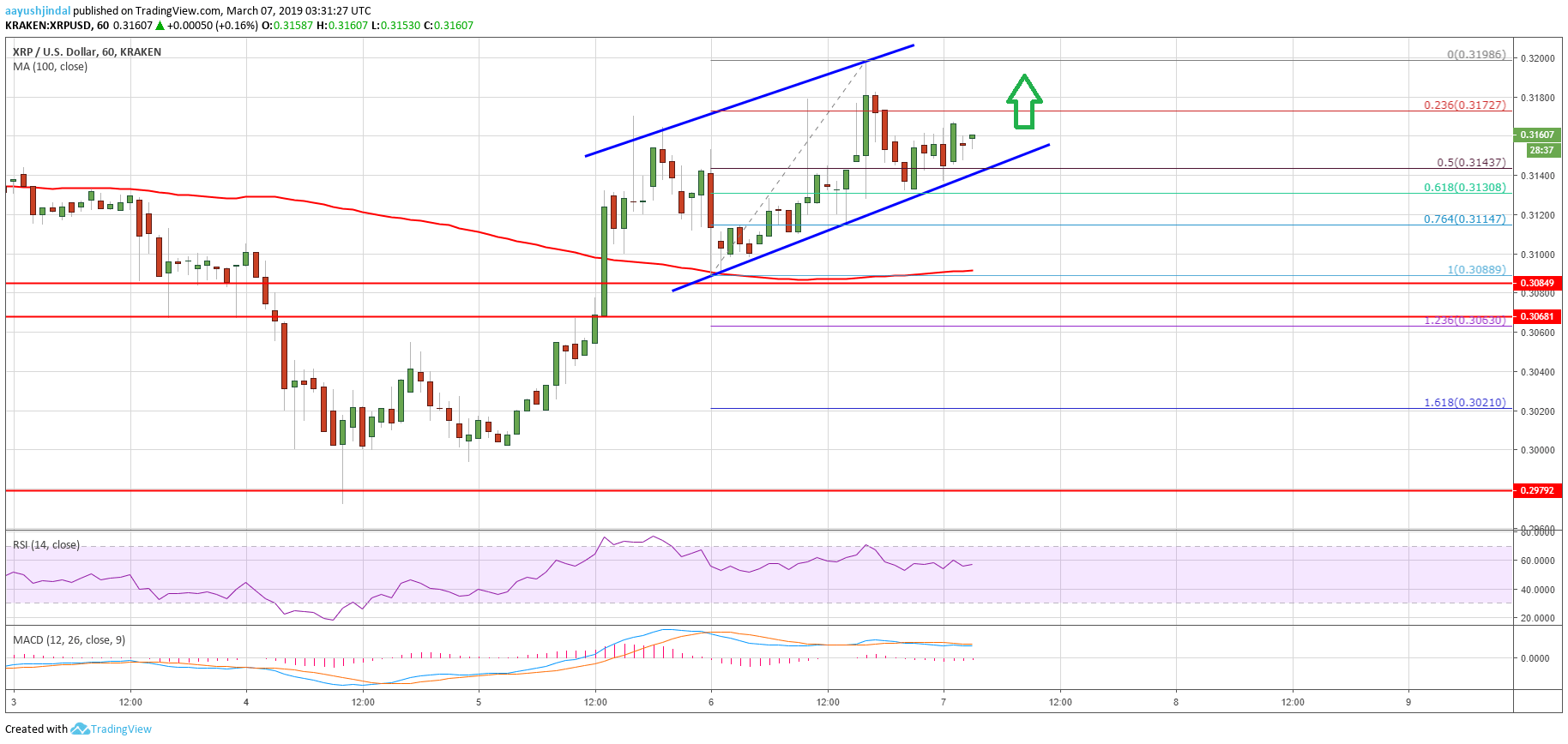 Ripple Price Analysis XRP Chart