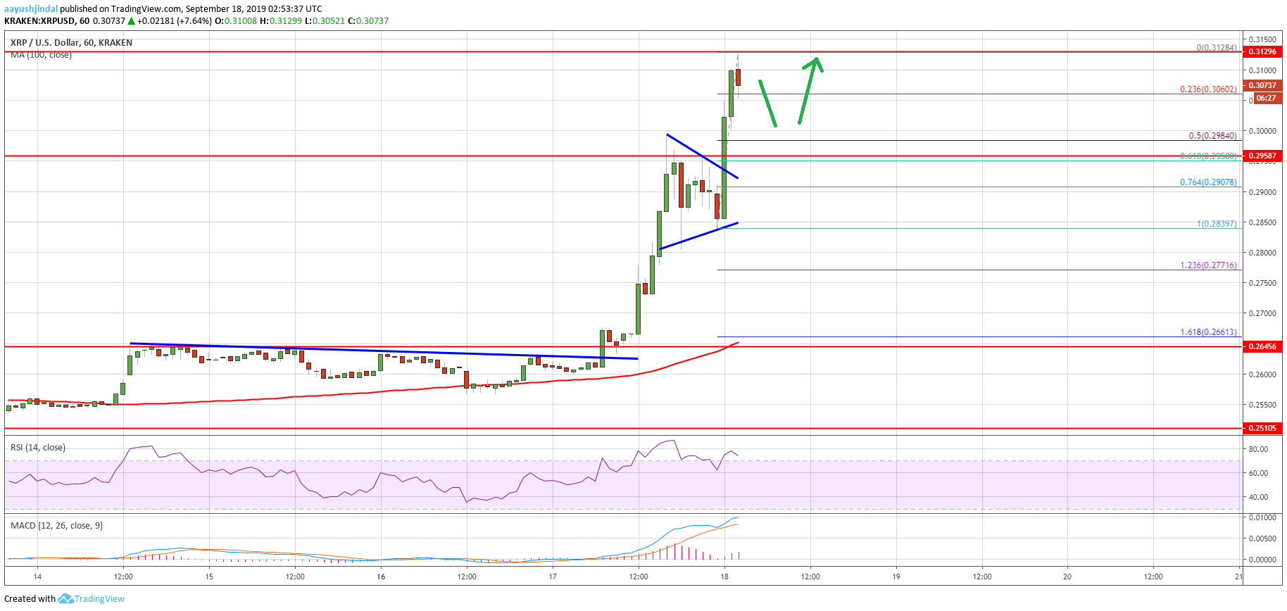 Ripple Price Analysis XRP Chart