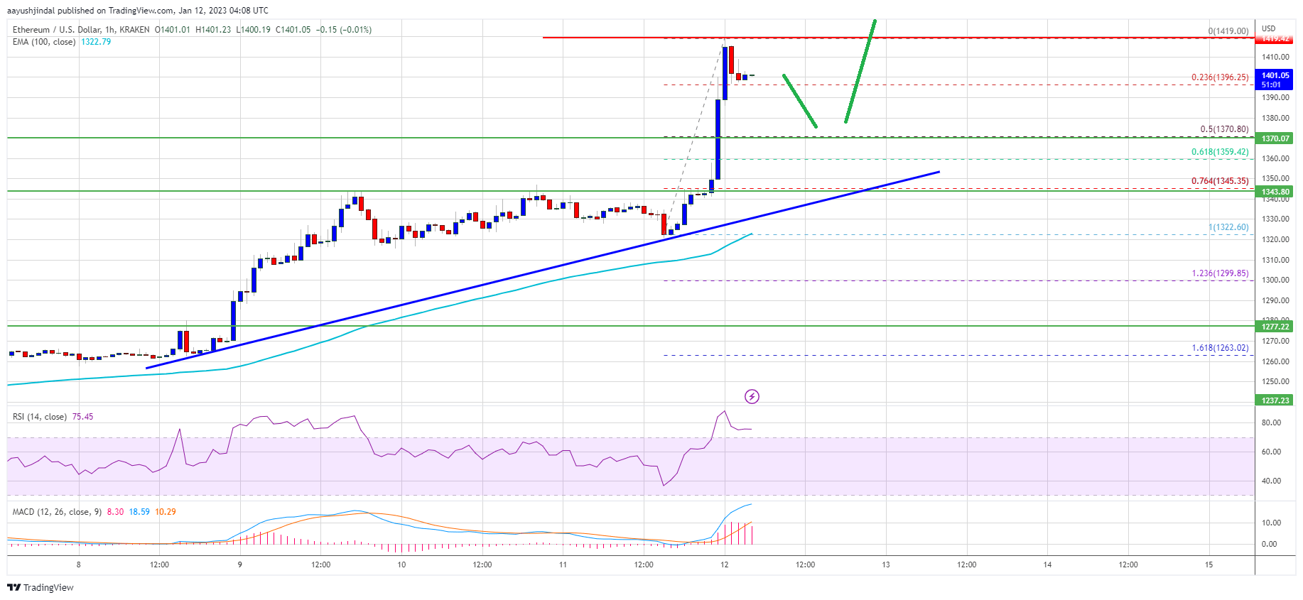 Ethereum Price Climbs 5%